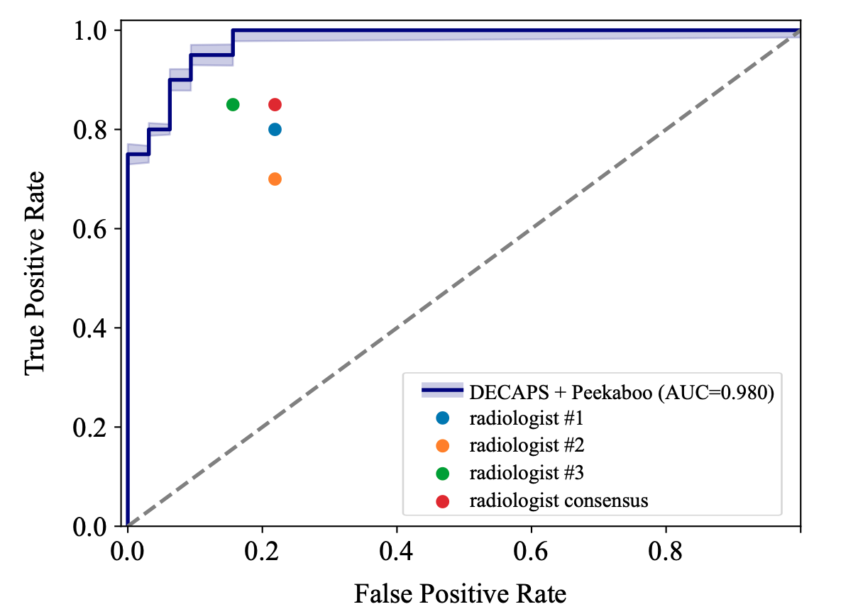 COVID-19 Detection